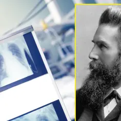 Portret Wilhelma Röntgena, który odkrył promienie X, obok zdjęć rentgenowskich płuc.