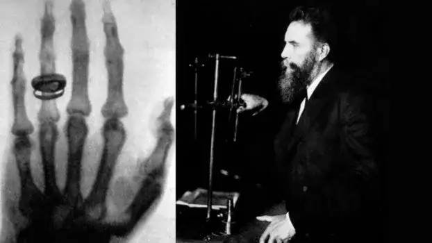 Zdjęcie Wilhelm Roentgen i jego wynalazek: jak promienie X zmieniły medycynę
